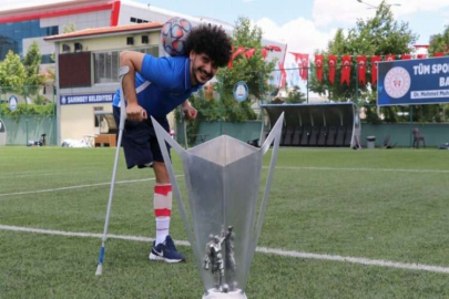 Ayağını kaybetti ama futbol tutkusundan vazgeçmedi
