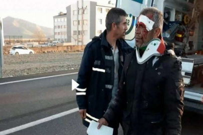 Yüzü gözü kanlar içinde kendisine çarpan aracı sordu