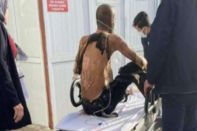 Üzerine benzin döküp yaktı, o anlar saniye saniye kaydedildi