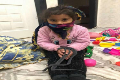 Pitbull saldırısına uğrayan Asiye’nin görüntüleri tepki topladı