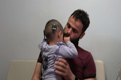 İlk kez biyonik kulak ile duymaya başladılar
