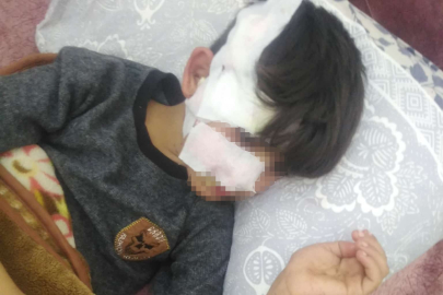 Sokak köpeklerinin saldırısına uğradı